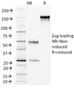 Endoglin/CD105 Antibody (ENG/1326), Novus Biologicals 20&mu;g; Unlabeled:Antibodies,
